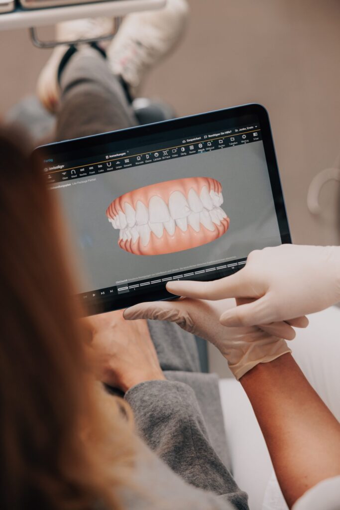 Digitaler 3D-Zahnscan auf dem Bildschirm – Aligner-Planung ohne Abdruckmasse